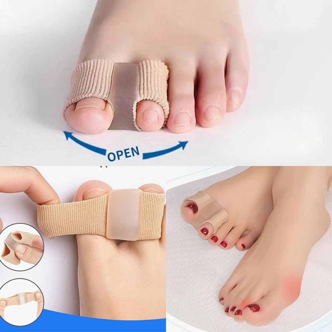 Pirštų separatorius ir nykščio deformacijos korekcija