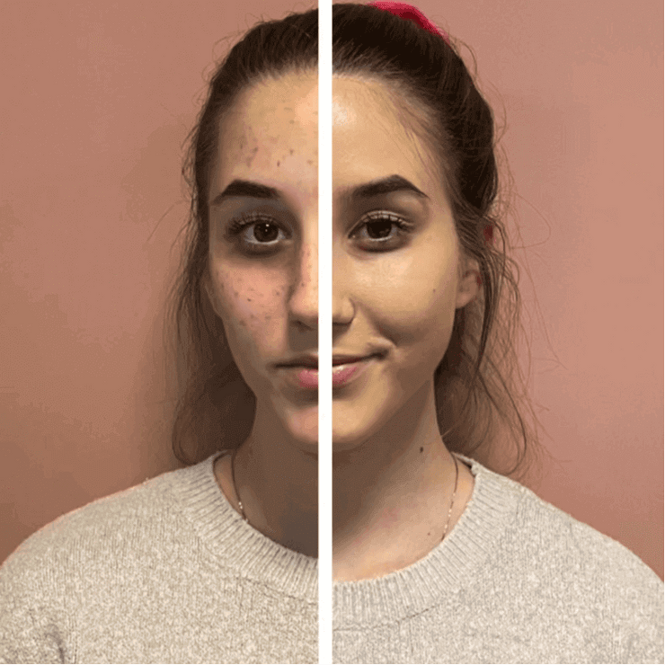MoistureSkin™ – kreminis pagrindas su kempine – Drėkinamasis – Kiekvienam odos tipui - prekinis.lt